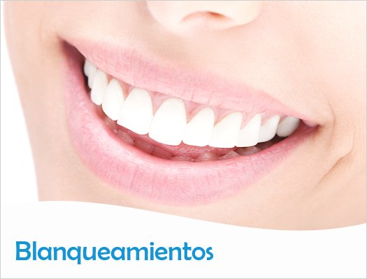 Estética Dental - Blanqueamientos